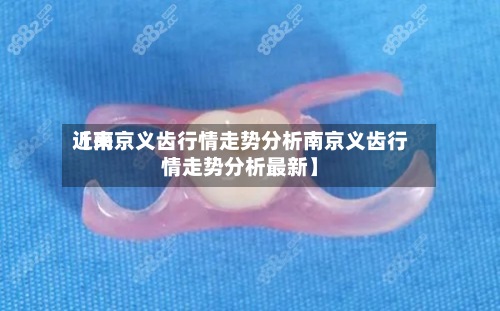 近来【南京义齿行情走势分析南京义齿行情走势分析最新】