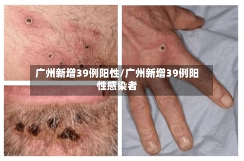 广州新增39例阳性/广州新增39例阳性感染者