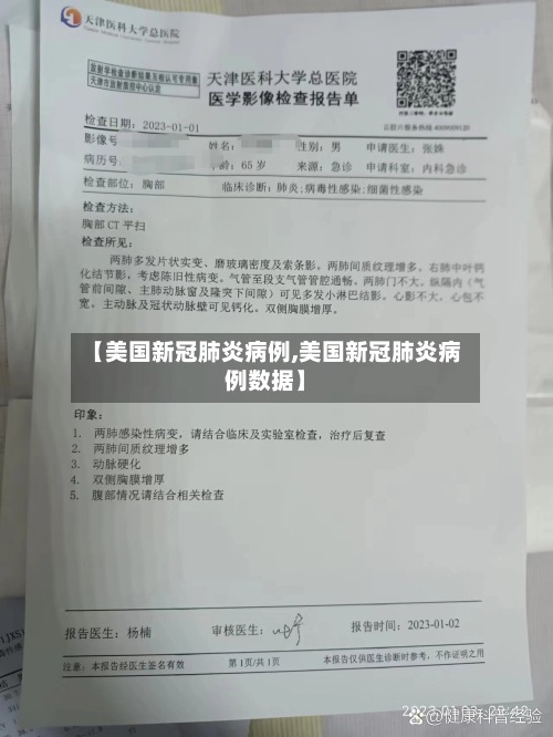 【美国新冠肺炎病例,美国新冠肺炎病例数据】-第2张图片